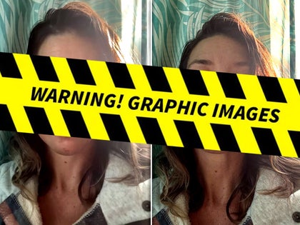 Evangeline Lilly injuries warning launch instagram